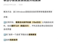 联想电脑黑屏一键恢复设置方法详解（通过简单设置，解决联想电脑黑屏问题）